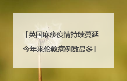 英国麻疹疫情持续蔓延 今年来伦敦病例数最多